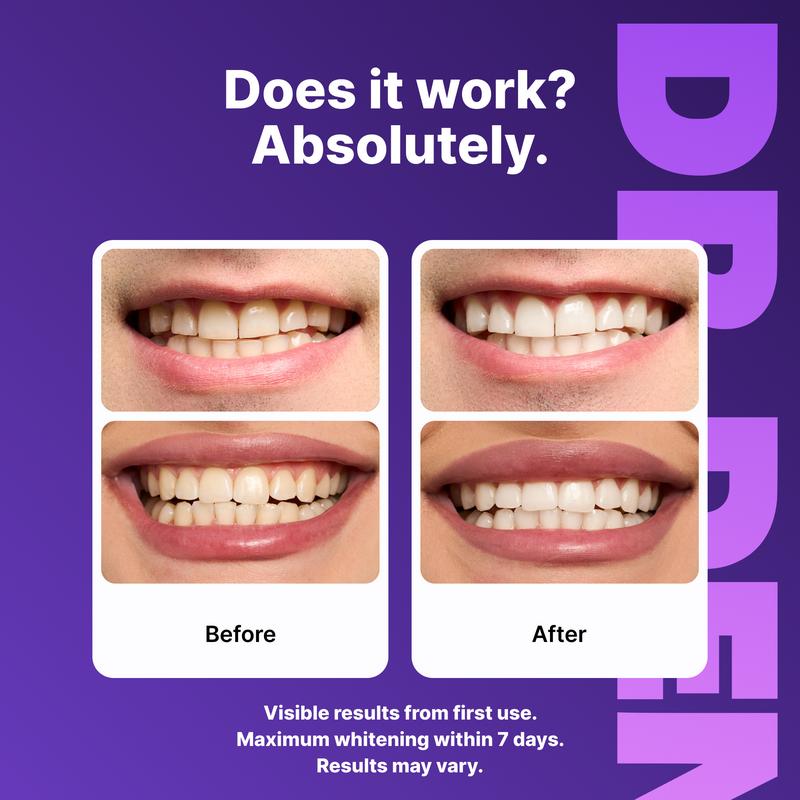 Purple Whitening Strips-A
