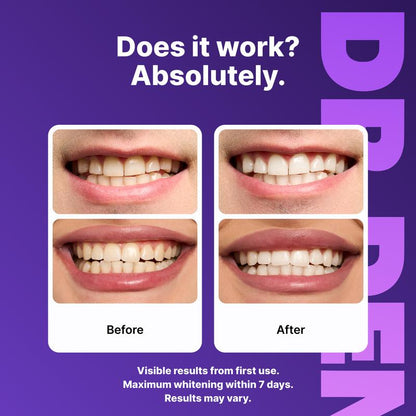 Purple Whitening Strips-A